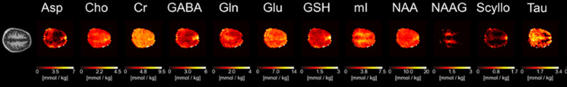 1H MRS MRSI spectroscopic imaging scan